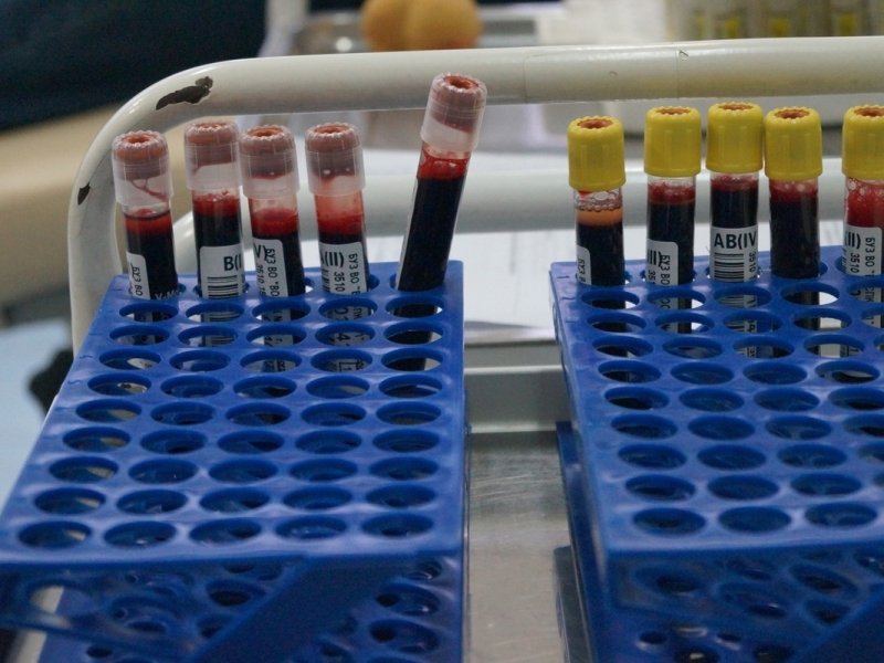 Более трех тысяч литров донорской крови и ее компонентов заготовили с начала года на Вологодчине